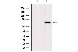 Western blot analysis of extracts from Sp2/0, using TCTN1 Antibody. (TCTN1 Antikörper  (N-Term))