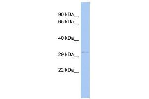 ODF4 antibody used at 1 ug/ml to detect target protein.
