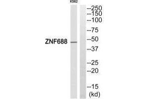 Western blot analysis of extracts from HepG2 cells, using ZNF688 antibody. (ZNF688 Antikörper)
