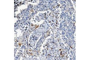 IHC analysis of ATG7 using anti-ATG7 antibody (ABIN7603109).