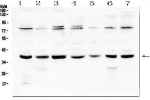 Western blot analysis of Rad51 using anti-Rad51 antibody (ABIN6719396).