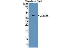 Detection of Recombinant ALDH1A1, Mouse using Polyclonal Antibody to Aldehyde Dehydrogenase 1 Family, Member A1 (ALDH1A1)
