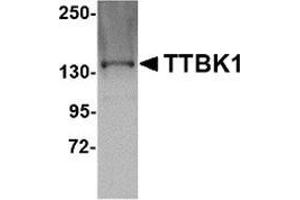 Western blot analysis of TTBK1 in Jurkat lysate with this product at 1 μg/ml. (TTBK1 Antikörper  (C-Term))
