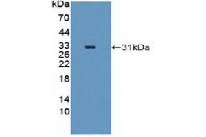 Western blot analysis of recombinant Human MAP2K2. (MEK2 Antikörper  (AA 86-331))