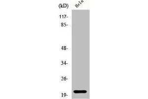 Western Blot analysis of HeLa cells using EID-1 Polyclonal Antibody (EID1 Antikörper  (Internal Region))
