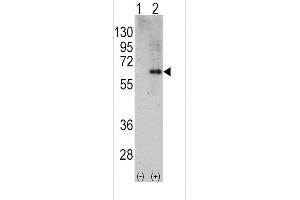 Western blot analysis of PRK (arrow) using rabbit polyclonal PRK Antibody (C-term) (R). (PRKAA2 Antikörper  (C-Term))