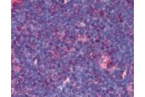 Immunohistochemistry (Paraffin-embedded Sections) (IHC (p)) image for anti-Tumor Necrosis Factor Receptor Superfamily, Member 8 (TNFRSF8) antibody (ABIN94067)