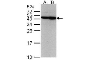 WB Image Sample(30 μg of whole cell lysate) A:293T B:A431, 12% SDS PAGE antibody diluted at 1:500 (ERCC8 Antikörper  (Internal Region))