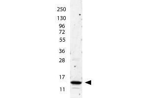 anti-Human IL-2 antibody shows detection of a band ~15 kDa in size corresponding to recombinant human IL-2. (IL-2 Antikörper)