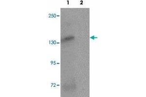 Western blot analysis of ATP2C2 in NIH/3T3 cell lysate with ATP2C2 polyclonal antibody  at 1 ug/mL in (1) the absence and (2) the presence of blocking peptide. (ATP2C2 Antikörper  (N-Term))
