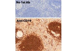 Immunohistochemistry (IHC) image for anti-CD19 Molecule (CD19) (C-Term) antibody (ABIN6254219)