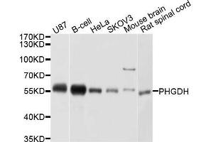 Western blot analysis of extracts of various cell lines, using PHGDH antibody. (PHGDH Antikörper  (AA 264-533))