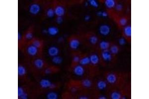 Immunofluorescence analysis of Human stomach tissue using CD23 Monoclonal Antibody at dilution of 1:200. (FCER2 Antikörper)