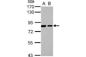 WB Image Sample (30 ug of whole cell lysate) A: H1299 B: HCT116 7. (SNX9 Antikörper)