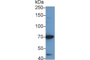 Detection of IL12Rb2 in BXPC3 cell lysate using Polyclonal Antibody to Interleukin 12 Receptor Beta 2 (IL12Rb2) (IL12RB2 Antikörper  (AA 559-647))