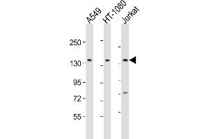 All lanes : Anti-FMN1 Antibody (Center) at 1:2000 dilution Lane 1: A549 whole cell lysate Lane 2: HT-1080 whole cell lysate Lane 3: Jurkat whole cell lysate Lysates/proteins at 20 μg per lane. (FMN1 Antikörper  (AA 270-304))