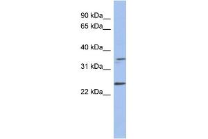WB Suggested Anti-NDN Antibody Titration: 0. (NDN Antikörper  (Middle Region))