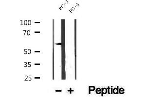Western blot analysis of extracts of PC-3 cells, using ETV5 antibody. (ETV5 Antikörper  (Internal Region))