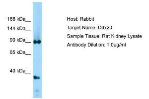 Host: Rabbit  Target Name: Ddx20  Sample Tissue: Rat Kidney lysates  Antibody Dilution: 1. (DDX20 Antikörper  (Middle Region))