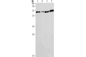 Gel: 12 % SDS-PAGE, Lysate: 40 μg, Lane 1-4: 231 cells, A549 cells, LoVo cells, HepG2 cells, Primary antibody: ABIN7128654(BIN3 Antibody) at dilution 1/225, Secondary antibody: Goat anti rabbit IgG at 1/8000 dilution, Exposure time: 2 minutes (BIN3 Antikörper)