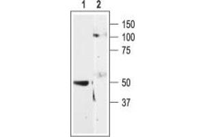 anti-Purinergic Receptor P2Y, G-Protein Coupled, 11 (P2RY11) (AA 357-373), (Intracellular) antibody