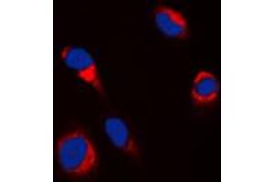 Immunofluorescent analysis of Tyrosinase staining in HepG2 cells. (TYR Antikörper  (C-Term))