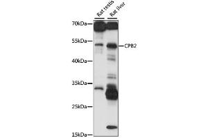 Western blot analysis of extracts of various cell lines, using CPB2 antibody (ABIN6293650) at 1:1000 dilution. (CPB2 Antikörper)