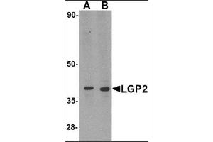 Western blot analysis of LGP2 in MDA-MB-361 cell lysate with this product at (A) 0. (DHX58 Antikörper  (N-Term))