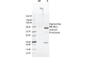 SDS-PAGE Analysis Purified FAT Mouse Monoclonal Antibody (FAT1-3D7/1). (FAT1 Antikörper  (Cytoplasmic Domain))