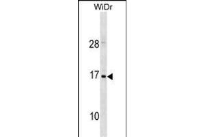 HBZ Antibody (C-term) (ABIN1881404 and ABIN2838673) western blot analysis in WiDr cell line lysates (35 μg/lane).