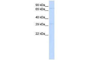WB Suggested Anti-PHOX2A Antibody Titration:  0. (PHOX2A Antikörper  (N-Term))