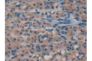 DAB staining on IHC-P; Samples: Rat Intestine Tissue (Caspase 3 Antikörper  (AA 29-175))