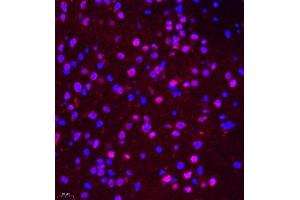 Immunofluorescence of paraffin embedded mouse brain using NSFL1C (ABIN7074865) at dilution of 1:650 (400x lens) (NSFL1C Antikörper)