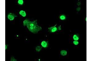 Image no. 3 for anti-T-Cell Acute Lymphocytic Leukemia 1 (TAL1) antibody (ABIN1501294) (TAL1 Antikörper)