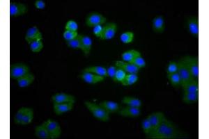 Immunofluorescence staining of HepG2 cells with ABIN7158443 at 1:266, counter-stained with DAPI. (Lipoprotein Lipase Antikörper  (AA 162-246))