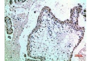 Immunohistochemical analysis of paraffin-embedded human-placenta, antibody was diluted at 1:200 (NOP56 Antikörper  (AA 191-240))