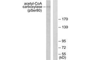 Western blot analysis of extracts from 293 cells treated with EGF 200ng/ml 5', using Acetyl-CoA Carboxylase (Phospho-Ser80) Antibody. (Acetyl-CoA Carboxylase Antikörper  (pSer80))