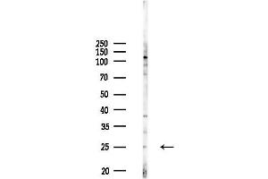 Western blot analysis of lysates from COLO205 cells(heat-shock,45 min treatment), using Recoverin Antibody at 1/1000 dilution.