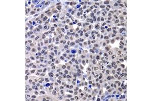 Immunohistochemistry (IHC) image for anti-H2A Histone Family, Member Y (H2AFY) (AA 123-372) antibody (ABIN6141569)