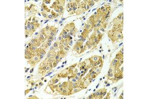 Immunohistochemistry of paraffin-embedded Human gastric using ARHGAP25 antibody at dilution of 1:100 (x400 lens). (ARHGAP25 Antikörper  (AA 1-370))