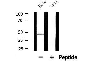 Western blot analysis of extracts from Hela, using ABHD8 Antibody. (ABHD8 Antikörper  (Internal Region))