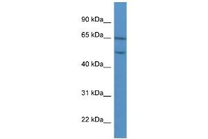 WB Suggested Anti-COL8A2 Antibody Titration: 0. (COL8a2 Antikörper  (C-Term))