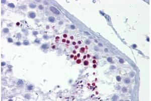 Anti-TLE4 antibody IHC staining of human testis.