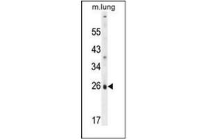 Western blot analysis of PQLC1 Antibody  in mouse lung tissue lysates (35ug/lane). (PQLC1 Antikörper  (Middle Region))