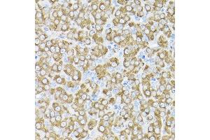 Immunohistochemistry (IHC) image for anti-THUMP Domain Containing 3 (THUMPD3) (AA 1-250) antibody (ABIN6149133)