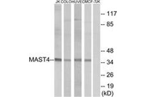 Western blot analysis of extracts from Jurkat/COLO/HuvEc/MCF-7 cells, using MAST4 Antibody. (MAST4 Antikörper  (AA 251-300))