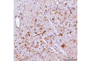 IHC analysis of Nms using anti-Nms antibody (ABIN7601460). (NMS Antikörper  (AA 36-144))