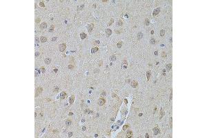 Immunohistochemistry of paraffin-embedded mouse brain using NME1 Antibody. (NME1 Antikörper  (C-Term))