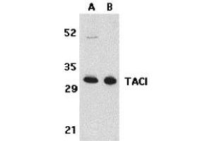 Western Blotting (WB) image for anti-Tumor Necrosis Factor Receptor Superfamily, Member 13B (TNFRSF13B) (N-Term) antibody (ABIN1031600) (TACI Antikörper  (N-Term))