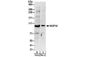 Western Blotting (WB) image for anti-NOP14 Nucleolar Protein (Nop14) (AA 750-800) antibody (ABIN7453145) (Nop14 Antikörper  (AA 750-800))